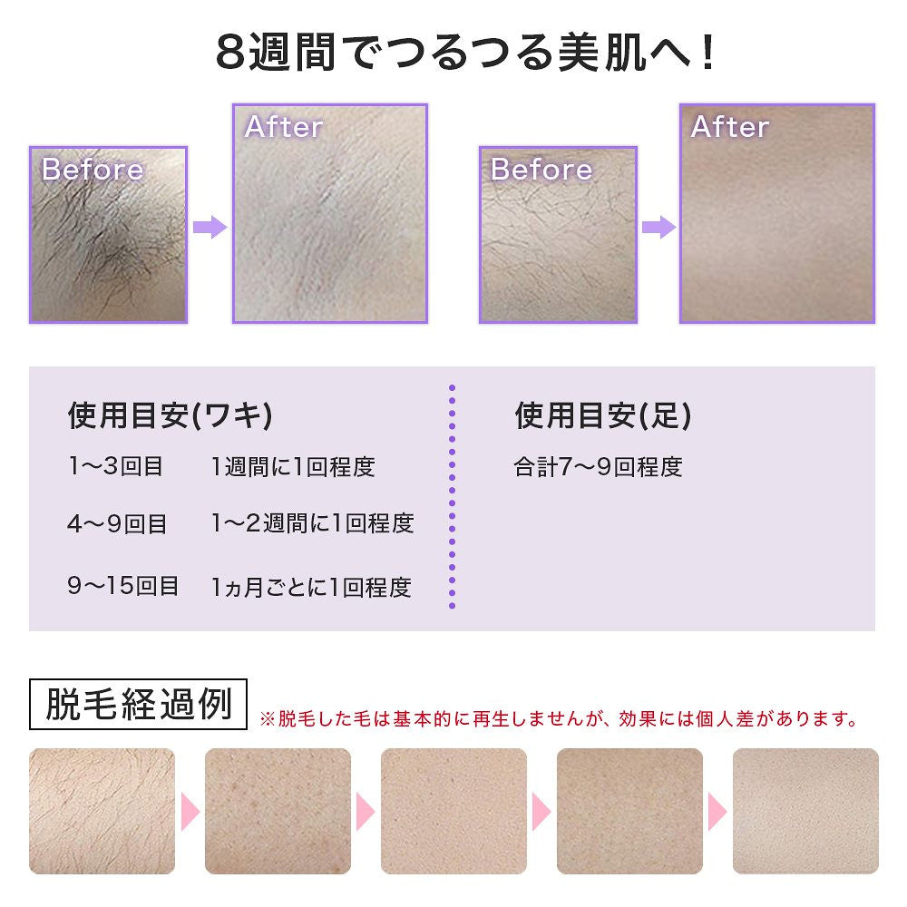 IPL脱毛器 自動照射 家庭用脱毛器 永久脱毛 サロン品質 全身ムダ毛処理 美肌機能